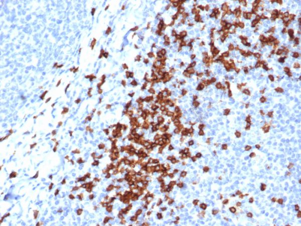 Formalin-fixed, paraffin-embedded human tonsil stained with CD8a Recombinant Rabbit Monoclonal Antibody (CD8/4391R).