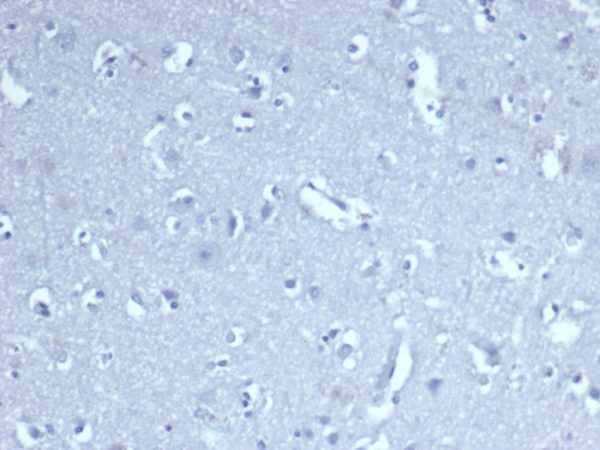 IHC analysis of formalin-fixed, paraffin-embedded human brain. Negative tissue control using CD8/4391R at 2ug/ml in PBS for 30min RT. HIER: Tris/EDTA, pH9.0, 45min. 2 °: HRP-polymer, 30min. DAB, 5min.