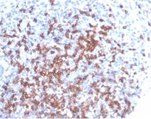 Formalin-fixed, paraffin-embedded human tonsil stained with CD8a Rabbit Polyclonal Antibody at 2ug/ml at RT. HIER: Tris/EDTA, pH9.0, 45min. 2°C: HRP-polymer, 30min. DAB, 5min.