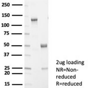 SDS-PAGE Analysis of Purified L-PLUNC Recombinant Rabbit Monoclonal (LPLUNC1/7059R). Confirmation of Purity and Integrity of Antibody.