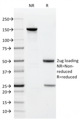 SDS-PAGE Analysis Purified CD9 Mouse Monoclonal Antibody (CD9/1619). Confirmation of Integrity and Purity of Antibody.