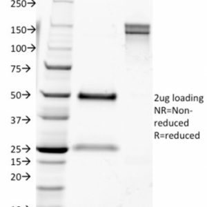 SDS-PAGE Analysis Purified CD9 Mouse Monoclonal Antibody (CD9/1631). Confirmation of Integrity and Purity of Antibody.