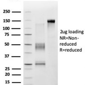 SDS-PAGE Analysis. Purified ZNF276 Mouse Monoclonal Antibody (PCRP-ZNF276-1A5).  Confirmation of Purity and Integrity of Antibody.