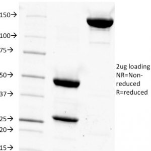 SDS-PAGE Analysis Purified CD14 Mouse Monoclonal Antibody (LPSR/927). Confirmation of Integrity and Purity of Antibody.
