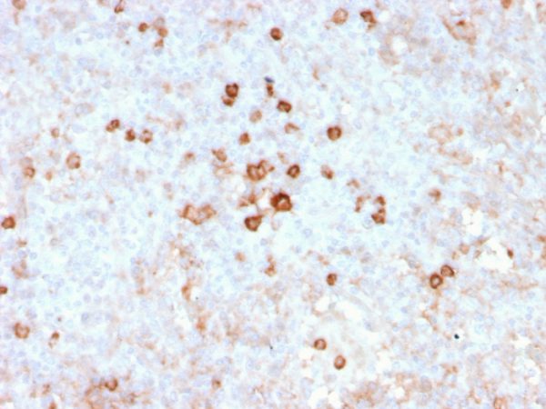 Formalin-fixed, paraffin-embedded human spleen stained with CD14 Recombinant Mouse Monoclonal Antibody (rLPSR/2408).