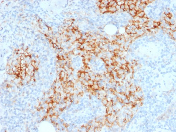 Formalin-fixed, paraffin-embedded human Lymph Node stained with CD14-Monospecific Mouse Monoclonal Antibody (LPSR/2385).