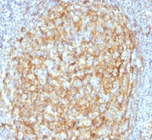 Formalin-fixed, paraffin-embedded human lymph node stained with CD14 Mouse Monoclonal Antibody (LPSR/2386). HIER: Tris/EDTA, pH9.0, 45min. 2 °: HRP-polymer, 30min. DAB, 5min.