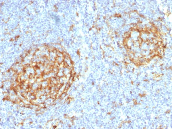 Formalin-fixed, paraffin-embedded human Lymph Node stained with CD14 Mouse Monoclonal Antibody (LPSR/2397).