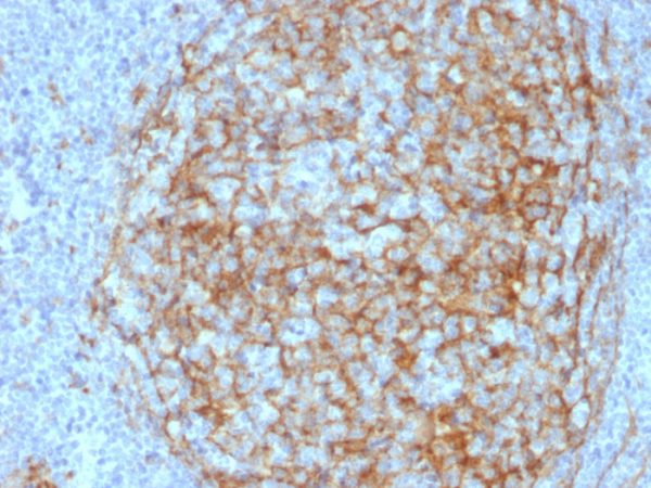 Formalin-fixed, paraffin-embedded human Lymph Node Stained with  CD14 Mouse Monoclonal Antibody (LPSR/2408).