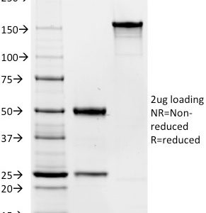SDS-PAGE Analysis Purified CD19 Mouse Monoclonal Antibody (Clone C19/366). Confirmation of Integrity and Purity of Antibody.