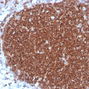 Formalin-fixed, paraffin-embedded human lymph node stained with CD19 Recombinant Mouse Monoclonal Antibody (rCD19/4591).