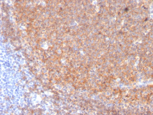 Formalin-fixed, paraffin-embedded human Tonsil stained with CD19 Monospecific Mouse Monoclonal Antibody (CD19/3117).