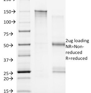 SDS-PAGE Analysis Purified CD20 Mouse Monoclonal Antibody (B9E9). Confirmation of Integrity and Purity of Antibody.