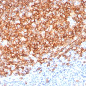 CD20 Antibody in Immunohistochemistry (IHC (P))
