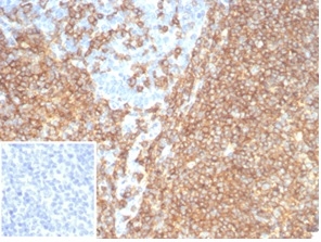Formalin-fixed, paraffin-embedded human tonsil stained with CD20 Recombinant Mouse Monoclonal Antibody (rMS4A1/7280) at 2ug/ml. Inset: PBS instead of primary antibody; secondary only negative control.