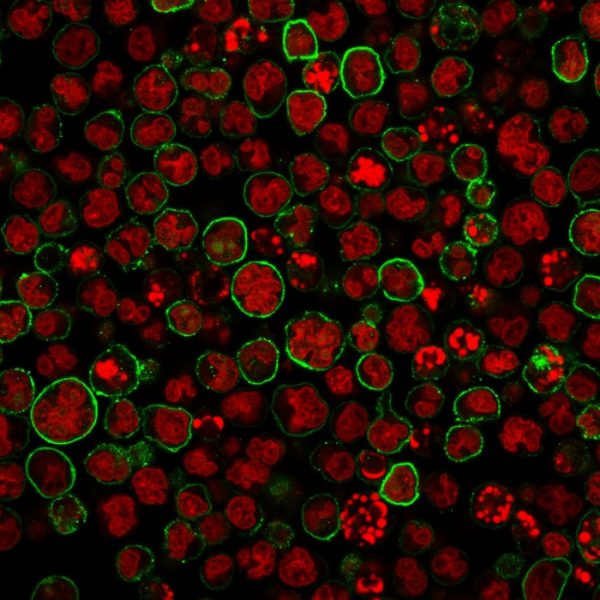 Immunofluorescence staining of MOLT-4 cells using CD20 Monoclonal Antibody (SPM494) followed by goat anti-Mouse IgG conjugated to CF488 (green). Nuclei are stained with Reddot.