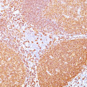 Formalin-fixed, paraffin-embedded human Tonsil stained with  CD20 Mouse Monoclonal Antibody (IGEL/773).