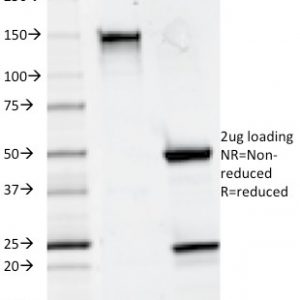 SDS-PAGE Analysis of Purified CD20 Mouse Monoclonal Antibody (93-1B3). Confirmation of Integrity and Purity of Antibody.