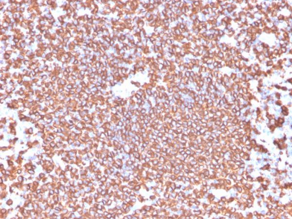 Formalin-fixed, paraffin-embedded human tonsil stained with CD20 Rabbit Recombinant Monoclonal Antibody (IGEL/4524R).
