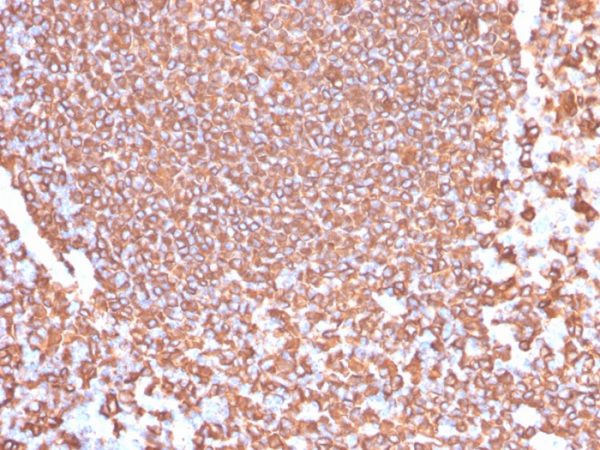 Formalin-fixed, paraffin-embedded human tonsil stained with CD20 Rabbit Recombinant Monoclonal Antibody (IGEL/4524R).