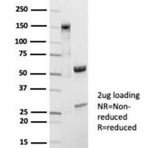 SDS-PAGE Analysis Purified CD20 Recombinant Rabbit Monoclonal Antibody (MS4A1/7015R). Confirmation of Purity and Integrity of Antibody.