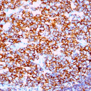 Formalin-fixed, paraffin-embedded human Tonsil stained with CD20 Rabbit Recombinant Monoclonal Antibody (IGEL/1497R).