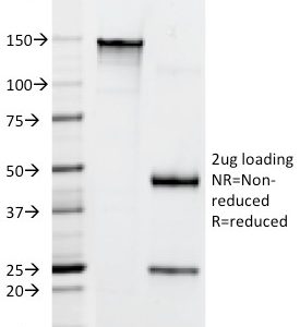 SDS-PAGE Analysis of Purified CD22 Mouse Monoclonal Antibody (FR10B4). Confirmation of Integrity and Purity of Antibody.