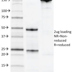 SDS-PAGE Analysis of Purified CD22 Mouse Monoclonal Antibody (MYG13). Confirmation of Integrity and Purity of Antibody.