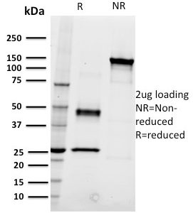 SDS-PAGE Analysis of Purified CD22 Mouse Monoclonal Antibody (RFB4). Confirmation of Integrity and Purity of Antibody.