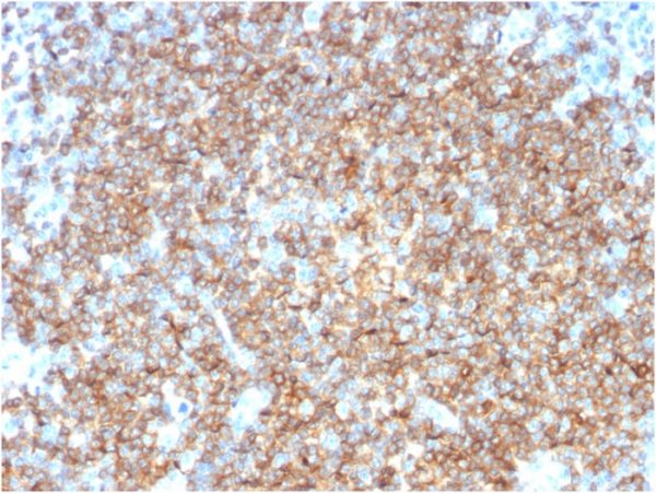 Formalin-fixed, paraffin-embedded human Tonsil stained with CD22-Monospecific Mouse Monoclonal Antibody (BLCAM/1795).