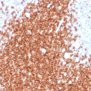 Formalin-fixed, paraffin-embedded human spleen stained with CD22 Recombinant Mouse Monoclonal Antibody (rBLCAM/4108).