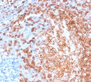 IHC analysis of formalin-fixed, paraffin-embedded human tonsil using rBLCAM/6749 at 2ug/ml. HIER: Tris/EDTA, pH9.0, 45min. Inset: PBS instead of primary antibody, secondary negative control.