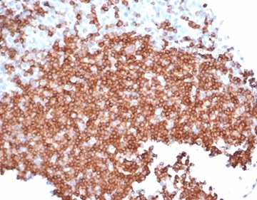 Formalin-fixed, paraffin-embedded human tonsil stained with CD22 Recombinant Mouse Monoclonal Antibody (rBLCAM/6749).