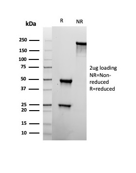 SDS-PAGE Analysis of Purified CD22 Recombinant Mouse Monoclonal Antibody (rBLCAM/6749). Confirmation of Purity and Integrity of Antibody.