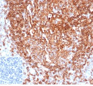 Formalin-fixed, paraffin-embedded human tonsil stained with CD22 Recombinant Rabbit Monoclonal Antibody (BLCAM/2637R). Inset: PBS instead of primary antibody, secondary control.