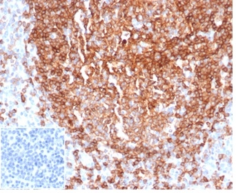 Formalin-fixed, paraffin-embedded human tonsil stained with CD22 Recombinant Rabbit Monoclonal Antibody (BLCAM/2637R). Inset: PBS instead of primary antibody, secondary control.