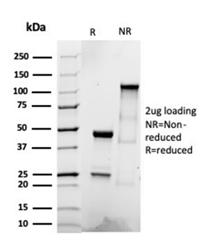 SDS-PAGE Analysis Purified CD22 Recombinant Rabbit Monoclonal Antibody (BLCAM/2637R). Confirmation of Integrity and Purity of Antibody.