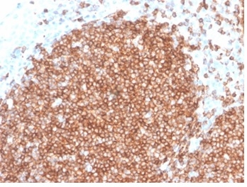 Formalin-fixed, paraffin-embedded human tonsil stained with CD22 Recombinant Rabbit Monoclonal Antibody (BLCAM/2637R).