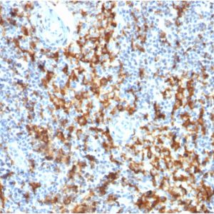 Formalin-fixed, paraffin-embedded human Lymph Node stained with CD163 Mouse Monoclonal Antibody (M130/1210).