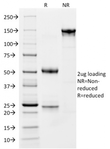 SDS-PAGE Analysis Purified CD163 Mouse Monoclonal Antibody (M130/1210). Confirmation of Integrity and Purity of Antibody.