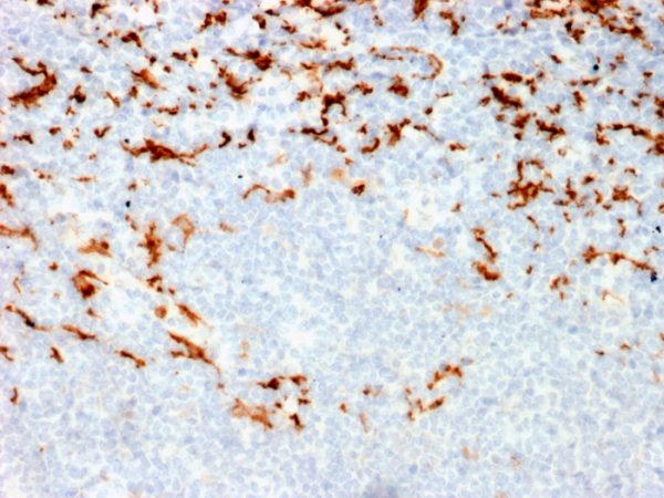Formalin-fixed, paraffin-embedded human Lymph Node in Colon stained with CD163 Mouse Monoclonal Antibody (M130/2164).