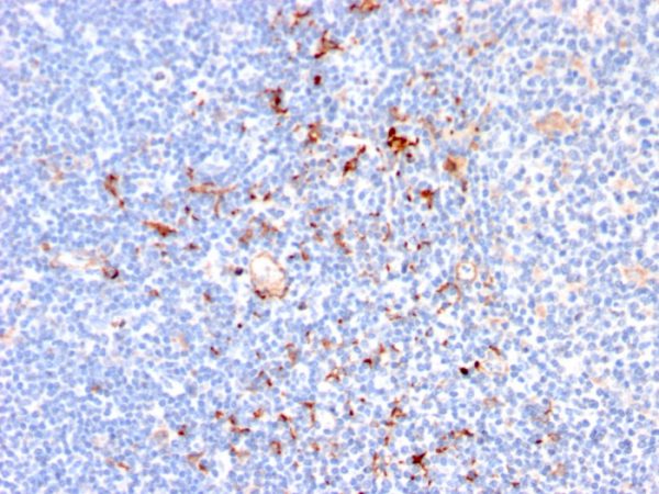 Formalin-fixed, paraffin-embedded human Tonsil stained with CD163 Mouse Monoclonal Antibody (M130/2164).