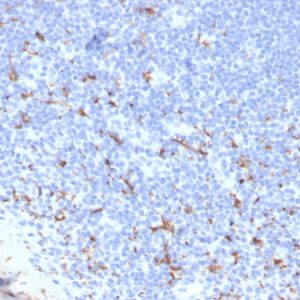 Formalin-fixed, paraffin-embedded human tonsil stained with CD163 Recombinant Rabbit Monoclonal Antibody (M130/3708R). HIER: Tris/EDTA, pH9.0, 45min. 2: HRP-polymer, 30min. DAB, 5min.