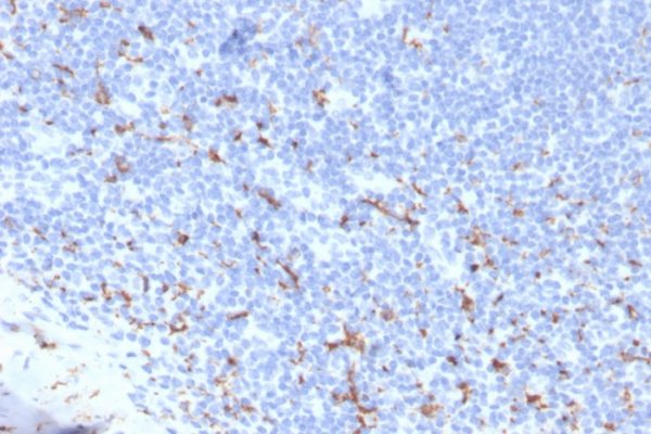 Formalin-fixed, paraffin-embedded human tonsil stained with CD163 Recombinant Rabbit Monoclonal Antibody (M130/3708R). HIER: Tris/EDTA, pH9.0, 45min. 2: HRP-polymer, 30min. DAB, 5min.
