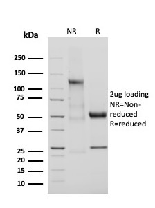 SDS-PAGE Analysis Purified Adiponectin Mouse Monoclonal Antibody (ADPN/4255) Confirmation of Integrity and Purity of Antibody.