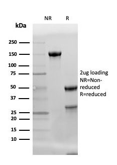 SDS-PAGE Analysis of Purified Adiponectin Mouse Monoclonal Antibody (ADPN/4256) Confirmation of Integrity and Purity of Antibody.