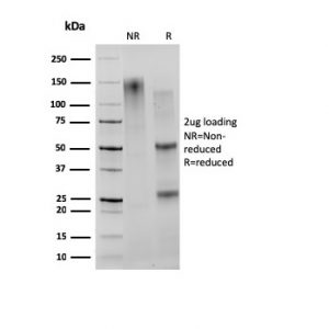 SDS-PAGE Analysis of Purified CD27 Mouse Monoclonal Antibody (203.6). Confirmation of Integrity and Purity of Antibody