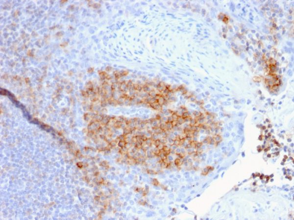 Formalin-fixed, paraffin-embedded human Tonsil stained with CD27 Mouse Monoclonal Antibody (LPFS2/1611).