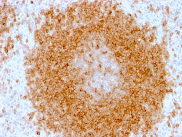 Formalin-fixed, paraffin-embedded human Spleen stained with CD27 Mouse Monoclonal Antibody (LPFS2/1611).
