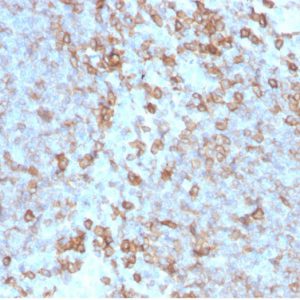 Formalin-fixed, paraffin-embedded human tonsil stained with CD27-Monospecific Mouse Monoclonal Antibody (LPFS2/4176).
